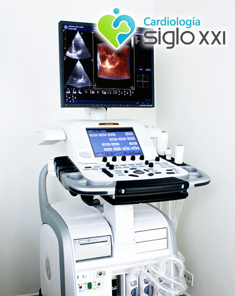 ECOCARDIOGRÁMA ECOCARDIOGRÁMA